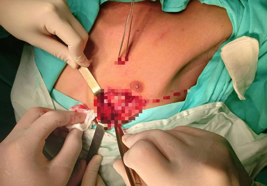 Уфимские врачи спасают жизнь 17-летнему парню. Обложка © Telegram / Айрат Рахматуллин