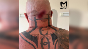 Хирург оценил чудесный случай с московским телохранителем, которого крепкая шея спасла от пули