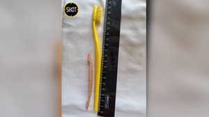 В Подмосковье парень проглотил зубную щётку, дверную ручку и дужки от очков