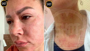 Мама изрезанной зимой в Химках школьницы на фоне стресса загремела в больницу