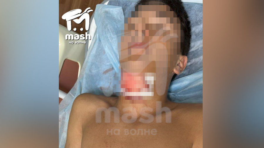 Школьник, напоровшийся на штырь при купании в Севастополе. Обложка © "Mash на волне"