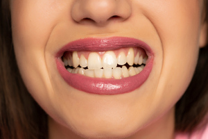 Бруксизм, прикус, пломбы и не только: Врач назвал шесть причин, почему крошатся зубы