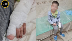 В Петербурге пришили оторванные пальцы ребёнку, но врачи не спешат давать прогнозы