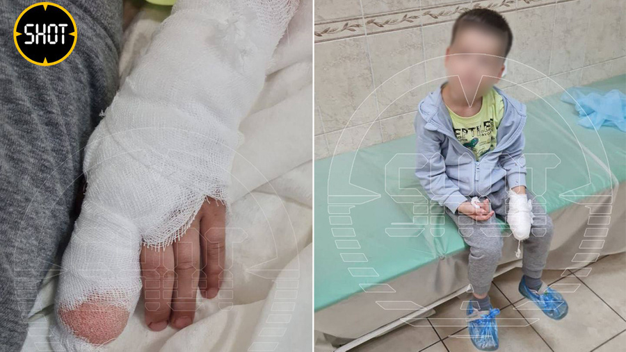Мальчик, которому женщина оторвала два пальца в питерском супермаркете. Обложка © Telegram / SHOT