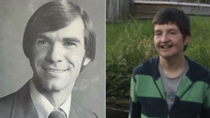 Вы ни за что не угадаете, сколько лет этим 10 людям, ведь генетика сыграла с ними злую шутку