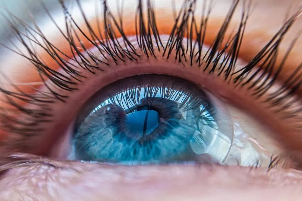 Россиянам рассказали, опасно ли менять цвет глаз хирургическим путём