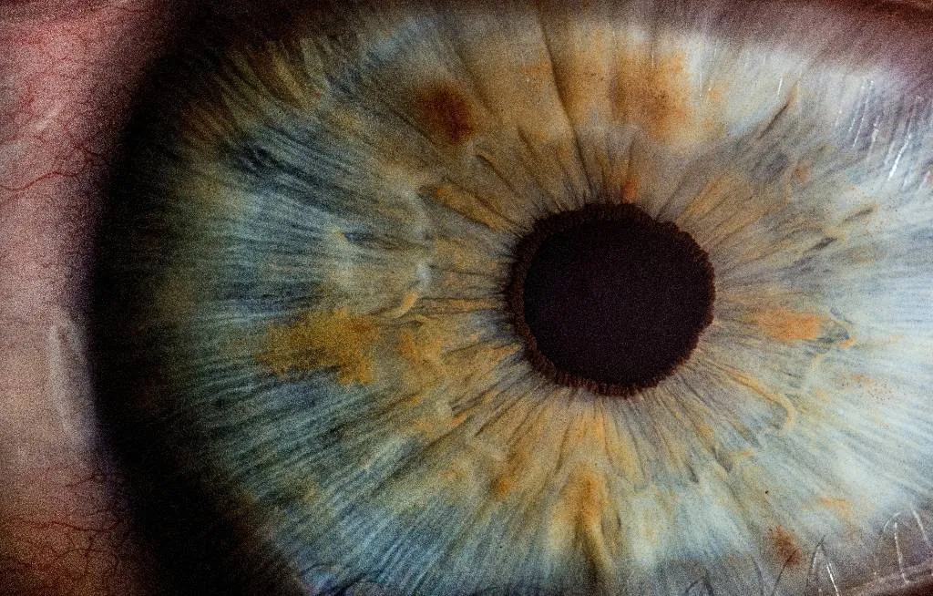 Учёные нашли способ определить сахарный диабет по фото глаз