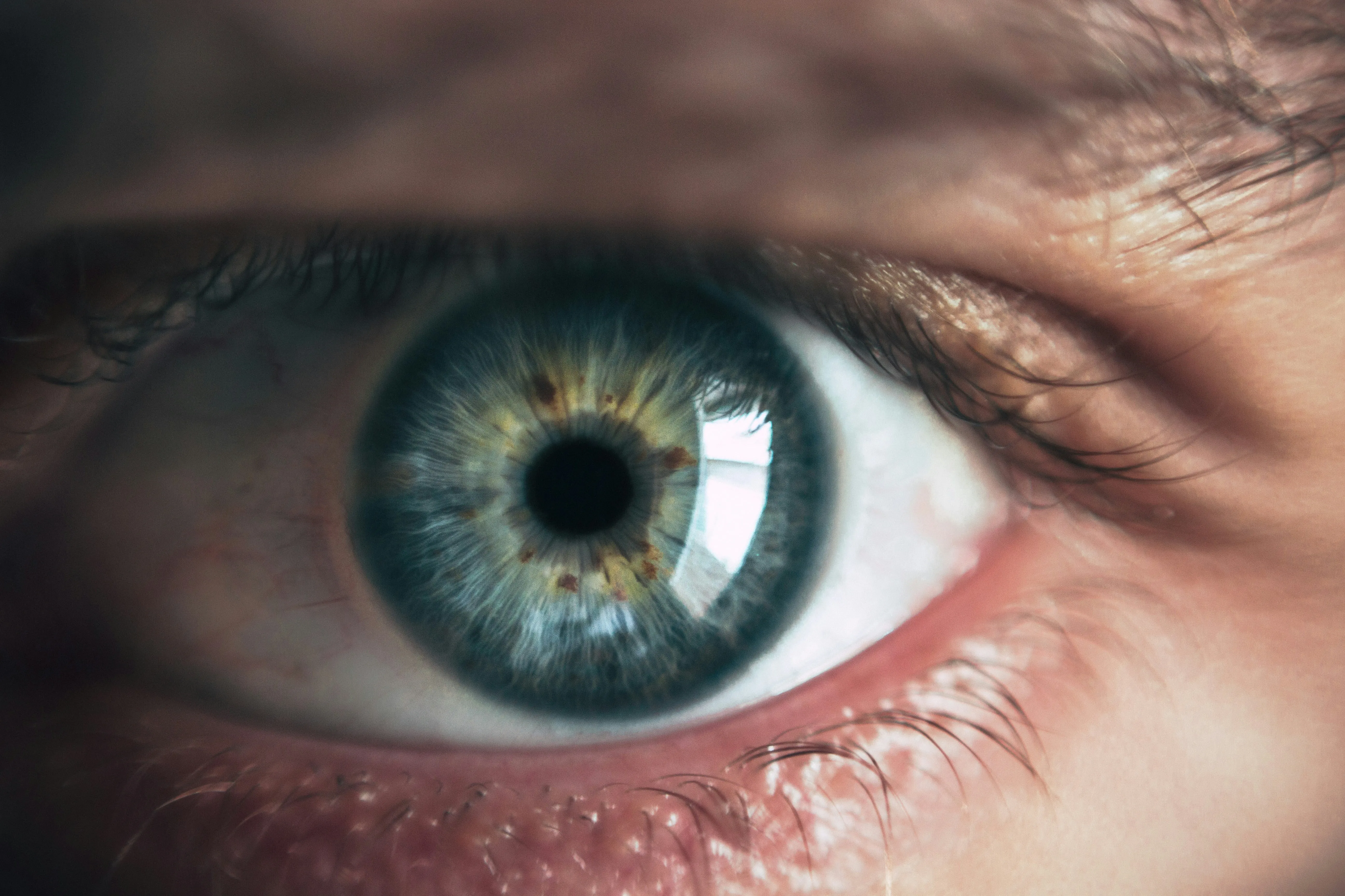 Офтальмолог назвал мушки перед глазами симптомом отслоения сетчатки глаза