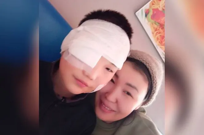 "Больно взглянуть": Домашний алабай разодрал лицо мальчику из Бурятии