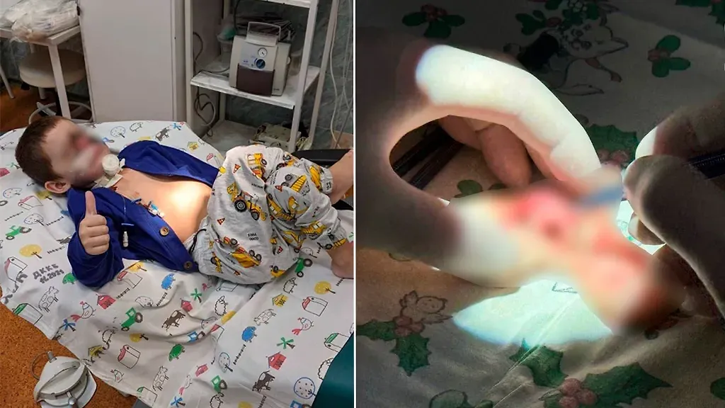 В Краснодаре попросили уволиться хирурга, пришившего ребёнку откушенное псом лицо