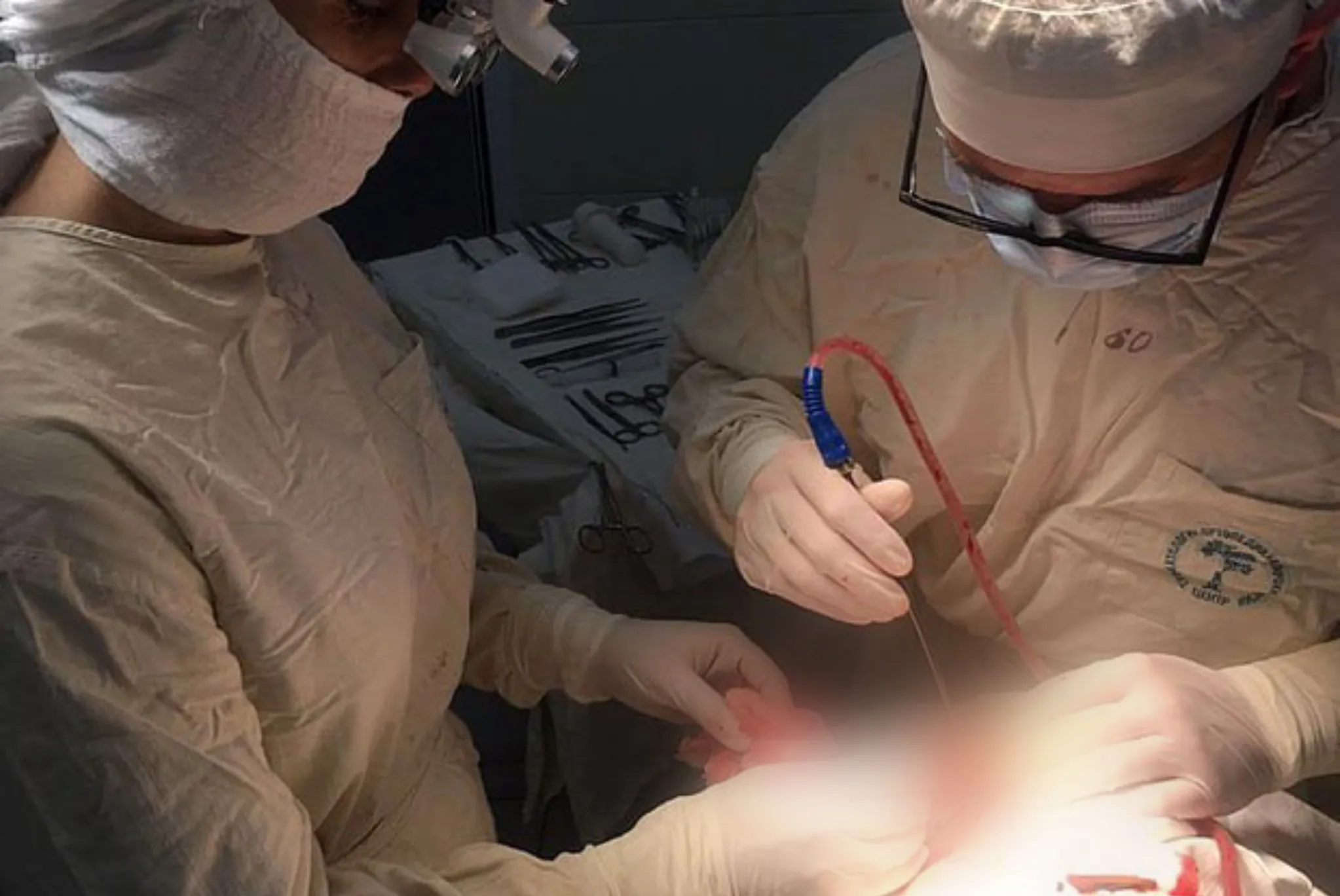 В Кировской области врачи удалили ветку из глазницы и мозга мотоциклиста