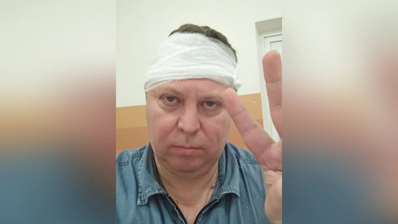 СК: Напавших на депутата Матвеева в Самаре задержали, возбуждено уголовное дело