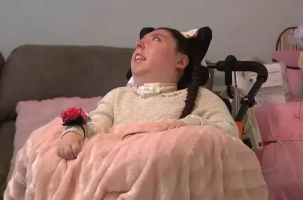 В США девушка, родившаяся без части мозга, дожила до 20 лет и побила рекорд