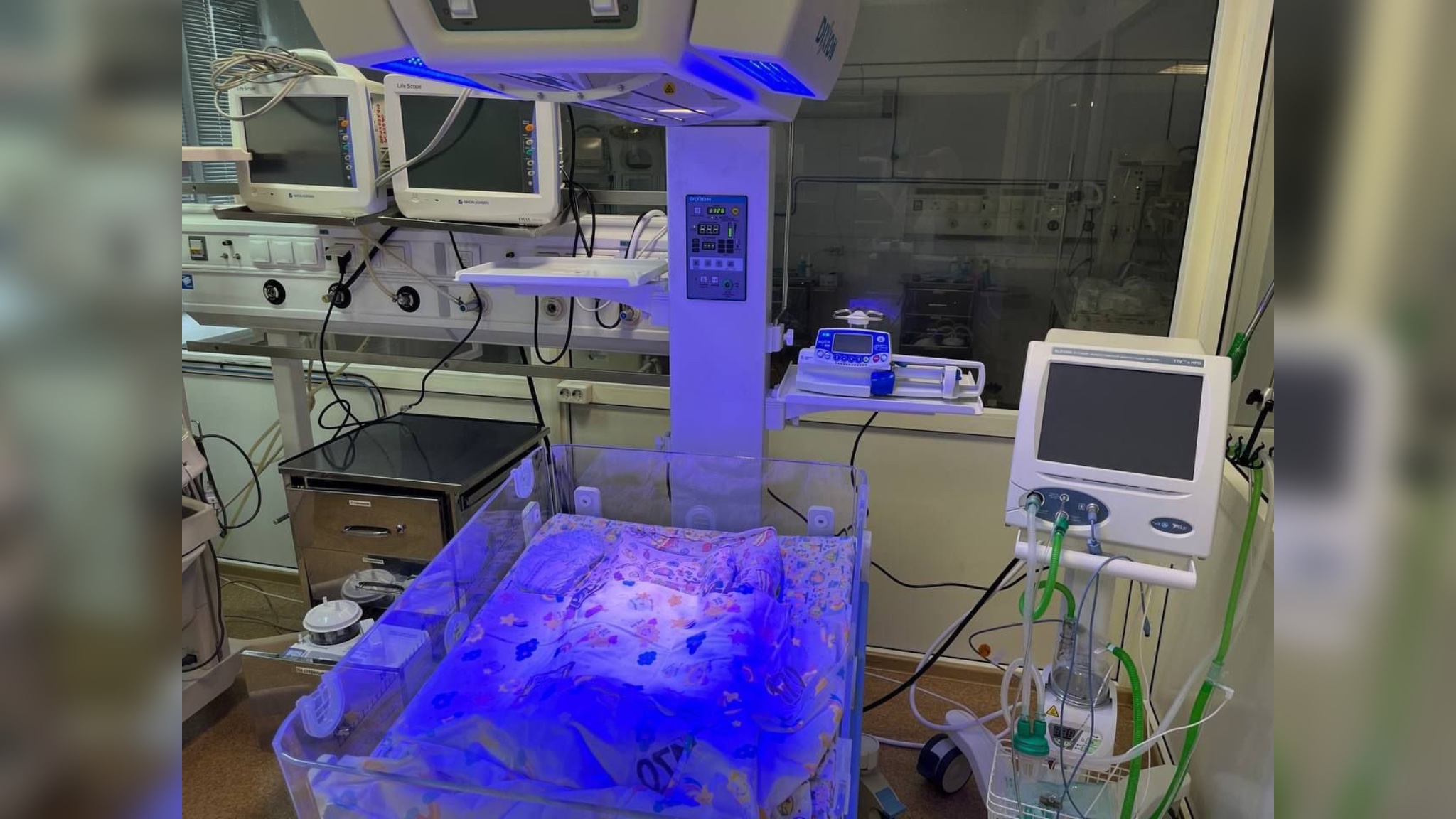 Роддом Новокузнецка использовал старое оборудование при финансировании в 50 млн рублей