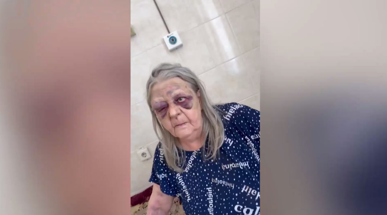Жительница Кузбасса заявила, что её бабушку избили в больнице и привязали к кровати