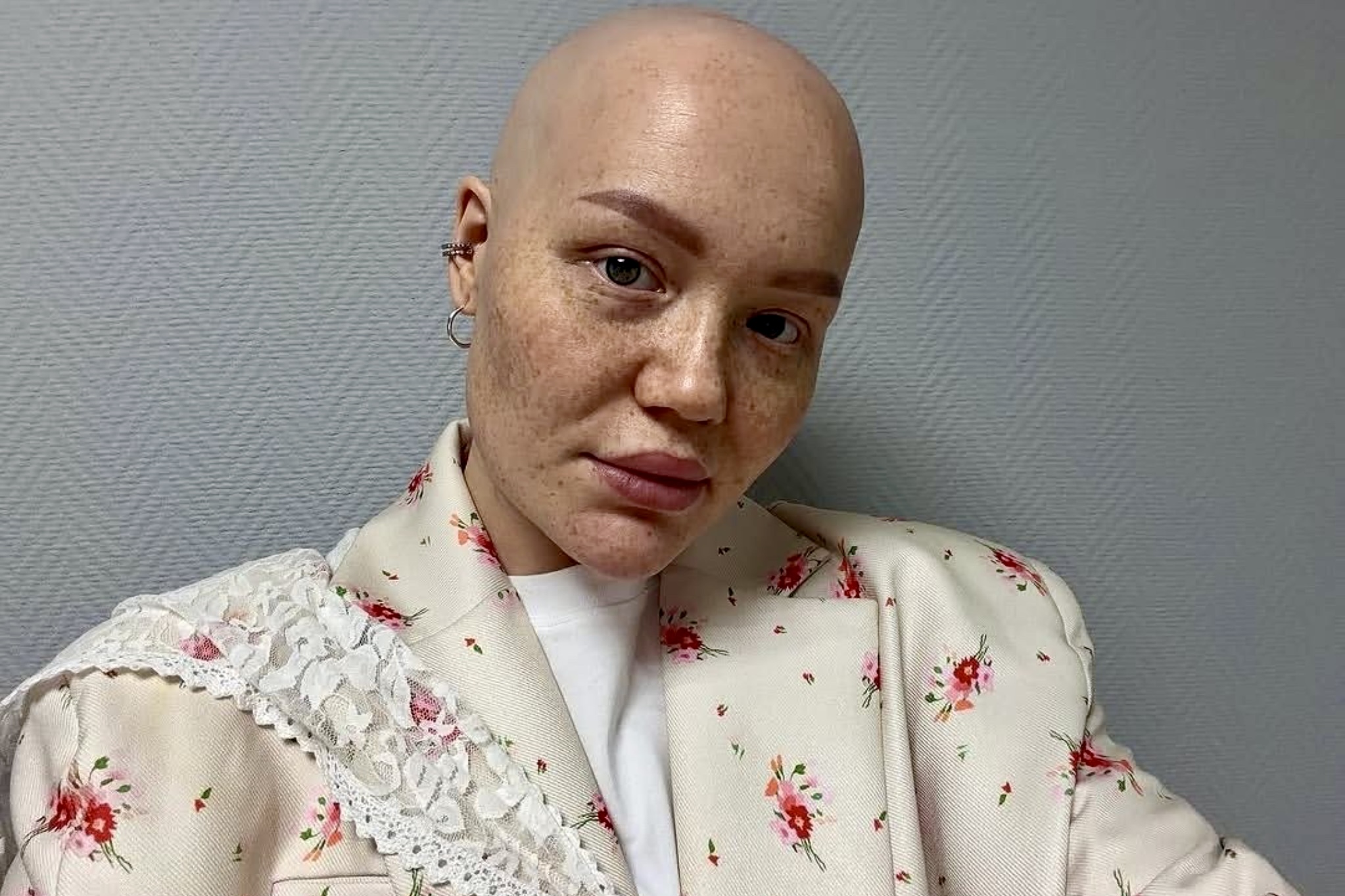 Россиянка, собиравшая деньги на лечение рака, попала под суд за мошенничество