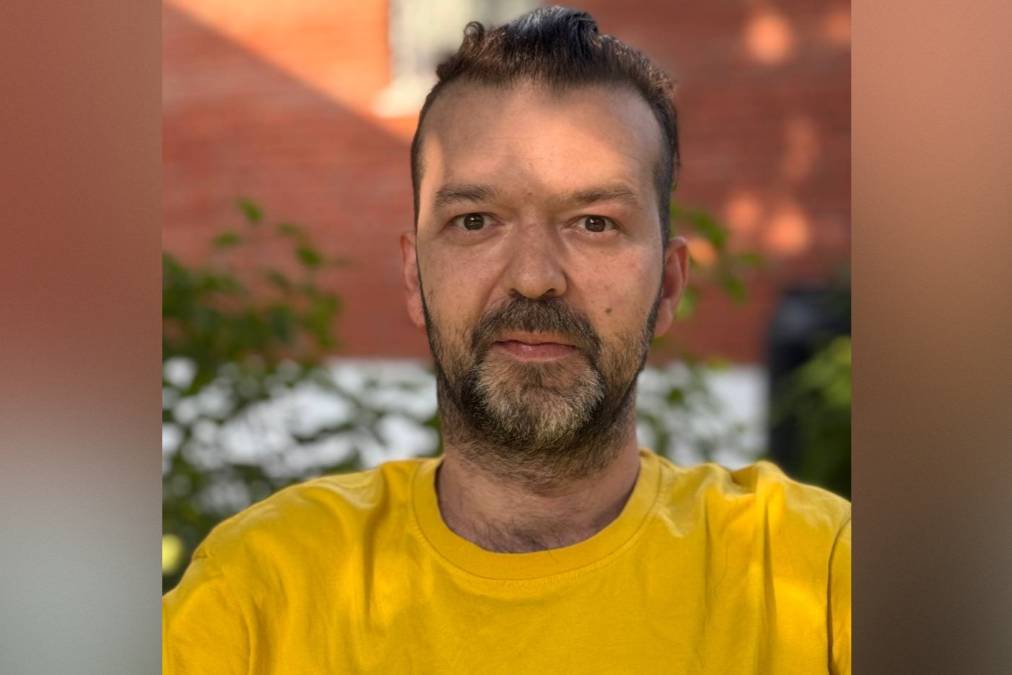 Создатель «Лепрозория» и Dirty Савович страдал от бокового амиотрофического склероза