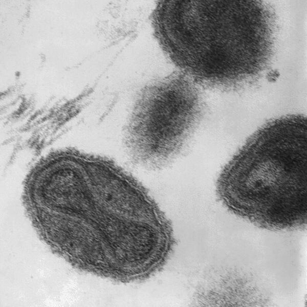 Вирус оспы.  Фото © Wikipedia