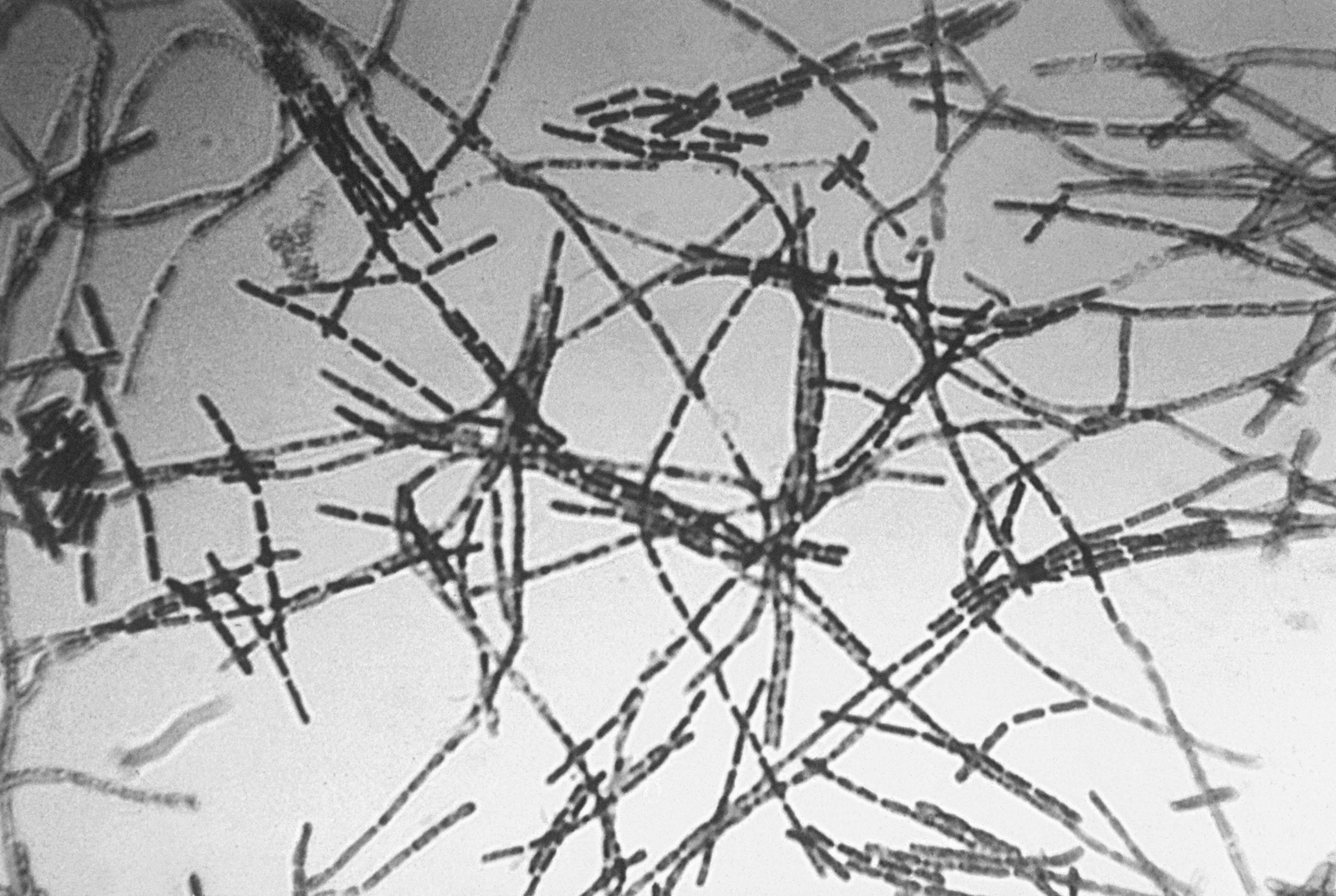 Bacillus anthracis. Фото © Wikipedia