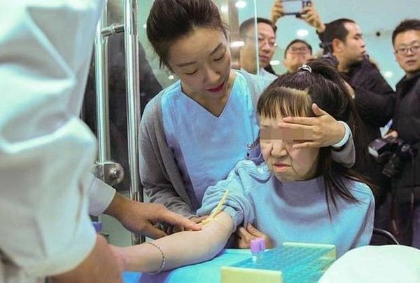 15-летняя школьница, которая из-за редкой болезни выглядела на все 60, обрела новое лицо благодаря хирургам