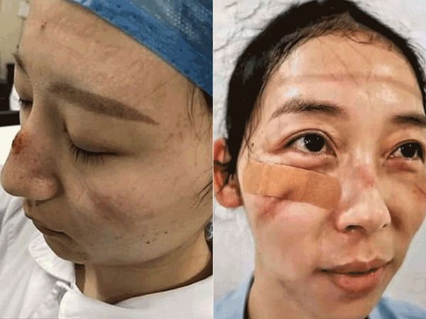 По ту сторону маски. Что стало с лицами врачей из Ухани, которые безустанно борются с коронавирусом 