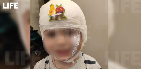 В Москве четырёхлетний ребёнок получил ожог из-за фокуса аниматора с сухим льдом