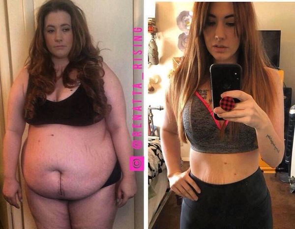 Девушка похудела на 64 кг, когда выяснила причину, почему она отъелась до таких больших размеров