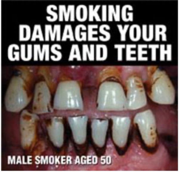 Австралийские сигареты показывают зубы 50-летнего курильщика