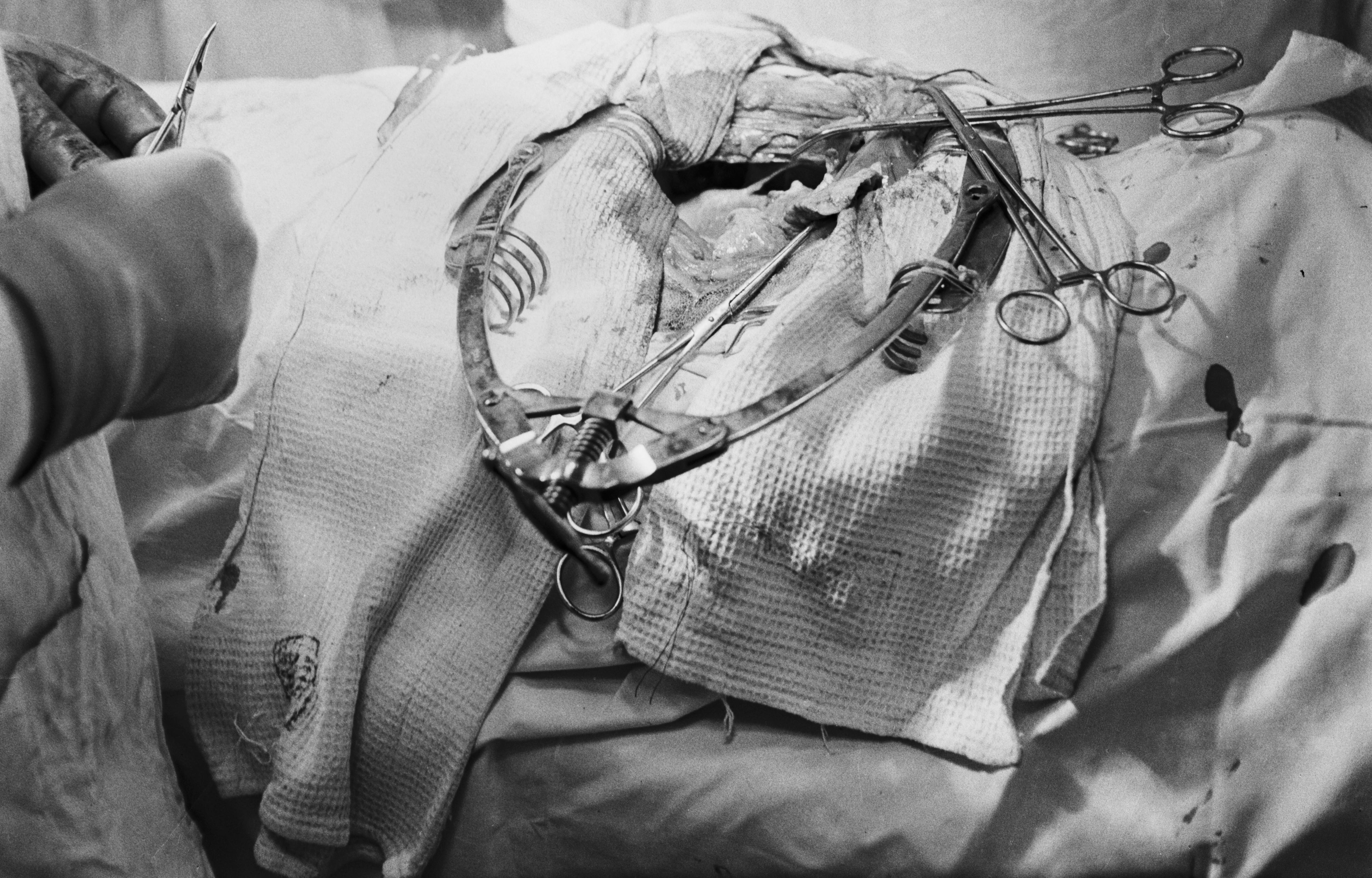 Демихов подготовил грудную полость собаки для пересадки второго сердца. Фото © ТАСС / Носов Петр