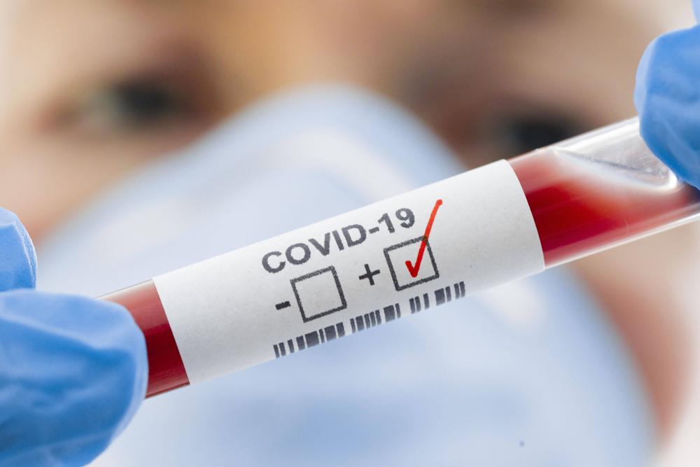Число заболевших коронавирусом в России за сутки возросло на 228 человек