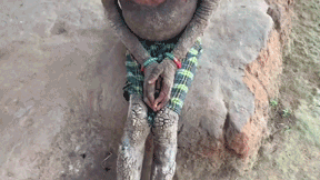 Семилетняя девочка превращается в камень из-за редкого заболевания кожи — видео