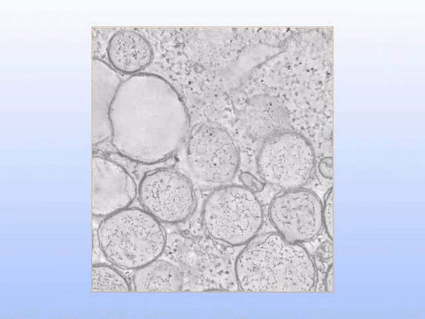 Процесс окончания сборки коронавируса в цитоплазме инфицированной клетки. Вокруг РНК-вируса идёт построение капсида. © Wikipedia