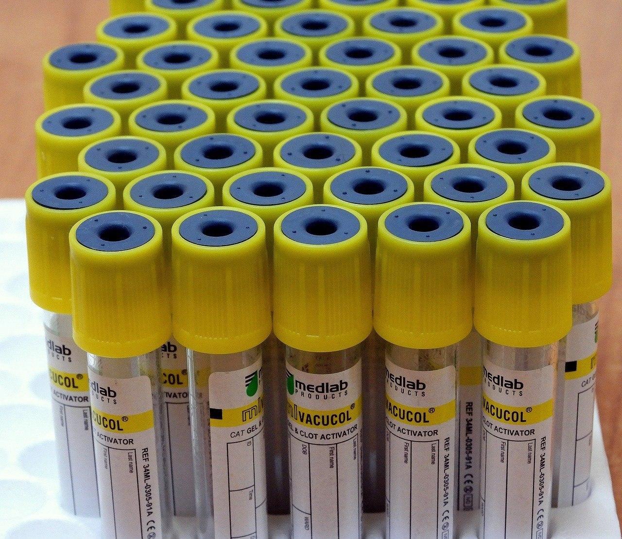 Тесты на иммунитет к коронавирусу зарегистрируют в России к 15 апреля